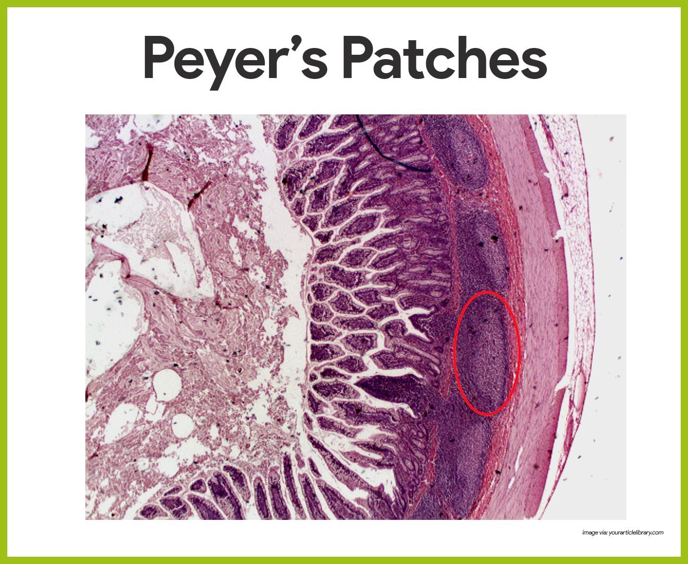Peyers patches