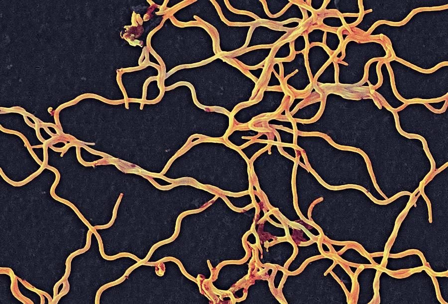Scanning electron micrograph of Borrelia burgdorferi