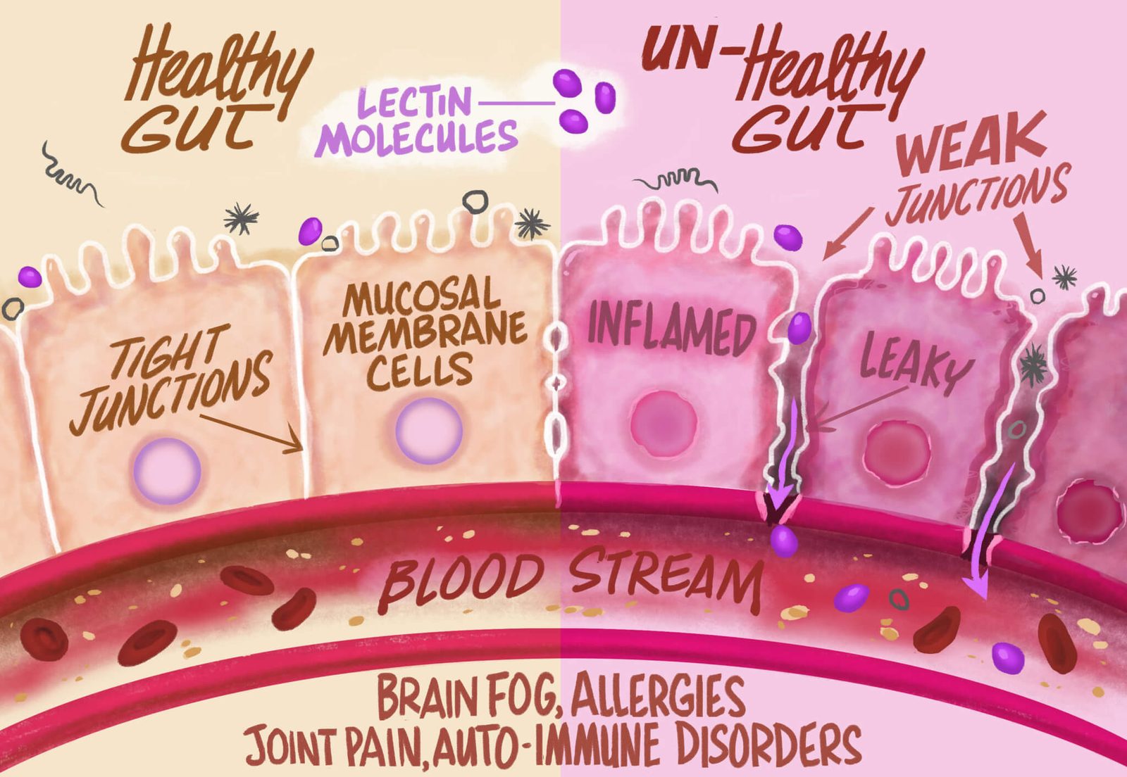 Lectins affect the gut